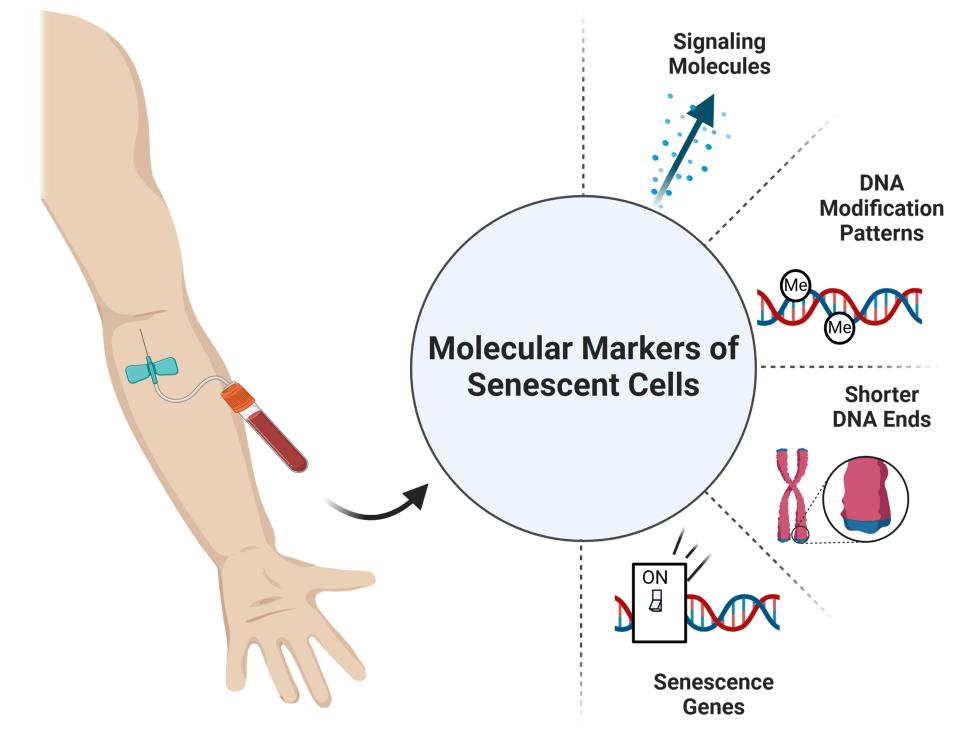 An arm with blood being drawn which is used for aging biomarker analysis.